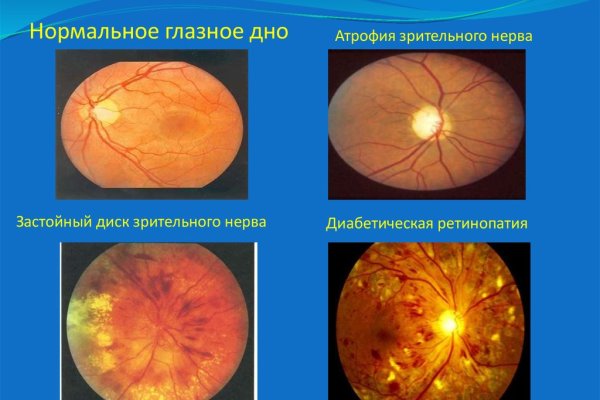 Как вывести деньги с кракена